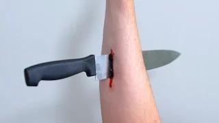 KNIFE IN ARM!