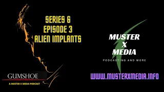 Gumshoe - Series 6 Episode 3 - Alien Implants