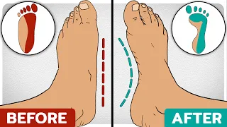 How to Build Foot & Ankle Strength at The Same Time