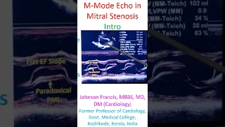 M-Mode Echo in Mitral Stenosis