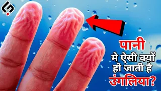 पानी में सिकुड़ क्यों जाती है उंगलिया? | Why Do We Get WRINKLY FINGERS in WATER?