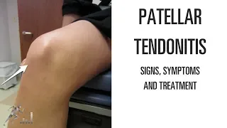 Patellar tendonitis: Signs, symptoms and remedies for this difficult knee problem