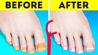 INCREDIBLE FEET HACKS AND SHOE CRAFTS