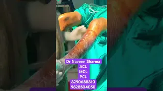 #acl #aclprocedure #naveensharma #mutilligament. #kneeinjury #aosih