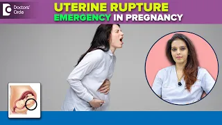 Will Uterus Rupture as Pregnancy advances?| Uterine Rupture Cause-Dr.Shwetha Anand | Doctors' Circle