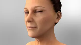 Face Lift Animation