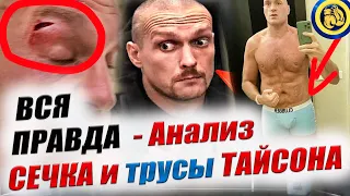 ФЬЮРИ боится УСИКА? Сечка - ПОСТАНОВА? Разбор Анализ #бокс