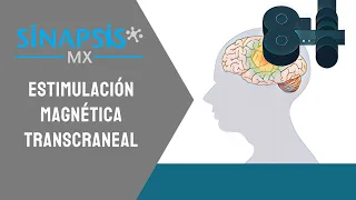 Estimulación magnética transcraneal, todo lo que necesitas saber.