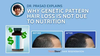 Why Supplements and Vitamins for Hair Loss Don’t Treat the Genetic Causes of Thinning Hair