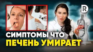 5 симптомов ЗАБОЛЕВАНИЯ ПЕЧЕНИ. Чем ОПАСНЫ проблемы с ПЕЧЕНЬЮ