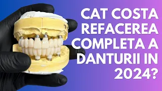 Cat costa sa iti refaci toata dantura in 2024? Pret implanturi dentare pentru toata gura.