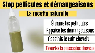 🌺94. Lotion pousse anti-pelliculaire : apaise les démangeaisons et irritations du cuir chevelu