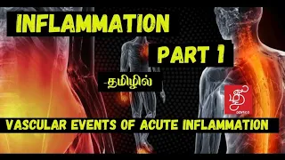 INFLAMMATION PART 1- VASCULAR EVENTS OF INFLAMMATION IN TAMIL