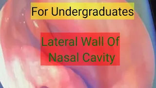 Anatomy of Lateral wall of Nasal cavity|lateral wall of nose