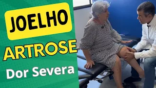 ARTROSE SEVERA NO JOELHO #artrose #joelho #fisioterapia