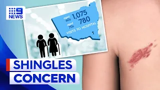 Hundreds aged in their 60s not eligible for free vaccine for shingles | 9 News Australia