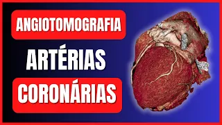 COMO É FEITO O EXAME DE ANGIOTOMOGRAFIA DAS ARTÉRIAS CORONÁRIAS | ANGIOTOMOGRAFIA ESCORE DE CÁLCIO