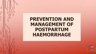 RCOG Guideline Prevention and Management of Postpartum Haemorrhage Part 1