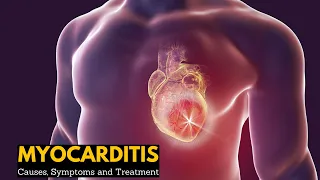 Myocarditis, Causes, Signs and Symptoms, Diagnosis, Treatment