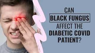 Black fungus deadly for diabetic covid patient | Aaarogya Clinic Dr. Sharad Gupta