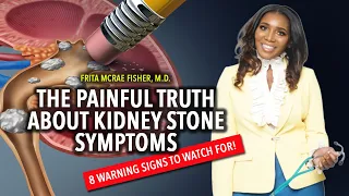 The Painful Truth About Kidney Stone Symptoms: 8 Warning Signs to Watch For
