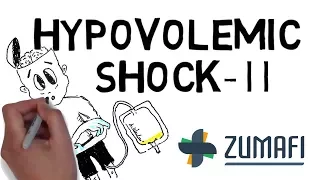 Hypovolemic Shock - Signs and Symptoms