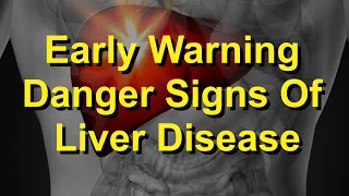 Don't Ignore These Early Warning Danger Signs Of Liver Disease