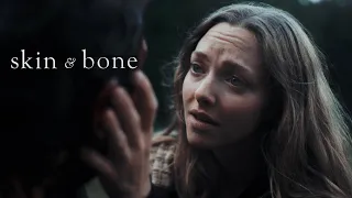 Skin & Bone // Official Teaser