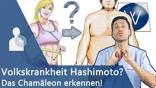 Hashimoto Thyreoiditis - Ein übles Chamäleon: Übergewicht, Müdigkeit, Haarausfall & weitere Symptome