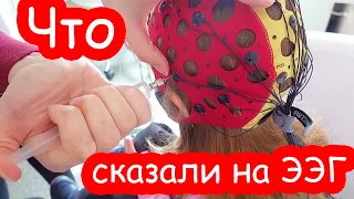 VLOG ВОТ ЭТО ДА что нам сказали на ЭЭГ