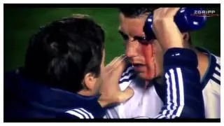 Lesion de Cristiano Ronaldo [11/11/2012]