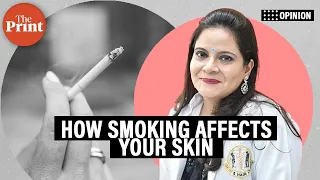 Wrinkles, pigmentation, Psoriasis, Cancer: How can smoking affect your skin