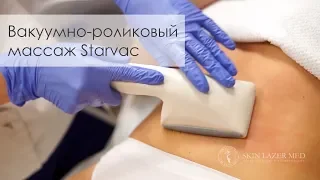 Вакуумно-роликовый массаж Старвак Starvac для коррекции фигуры