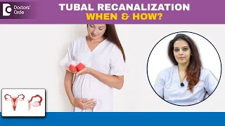 Tubal Sterlization Reversal to get Pregnant|TUBAL LIGATION REVERSAL-Dr.Shwetha Anand|Doctors’ Circle