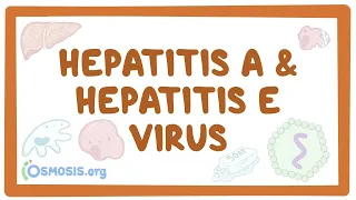 Hepatitis A and hepatitis E virus - causes, symptoms, diagnosis, treatment, pathology