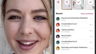 Ornament- Health App Ad