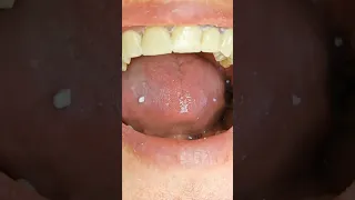 dentist 🦷. my job first video