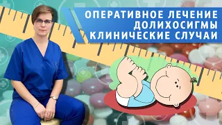 операция при долихосигме. Клинический случай.