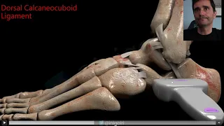 ANATOMY AND US ANKLE LATERAL LIGAMENTS