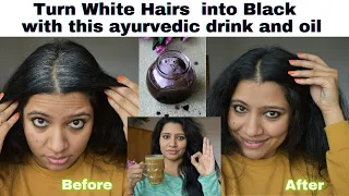 Turn White Hairs into Black With This Ayurvedic Drink And Homemade Oil/Treat Premature Hair Greying