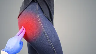 Piriformis Syndrome - Get rid of Your Butt Pain
