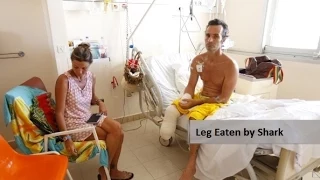 Surfer Killed After Shark Bites off Legs in Australia
