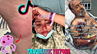 Hey Yo Something Traumatic Happened and Changed My Life Check | TIKTOK Daily #92