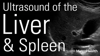 Ultrasound of the Liver and Spleen