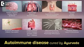 How is Ayurveda helpful in Autoimmune diseases - Dr. Jayaprakash Narayan
