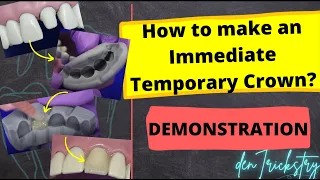 How to make an IMMEDIATE TEMPORARY CROWN?? (Direct Temporization Technique - Demonstration)