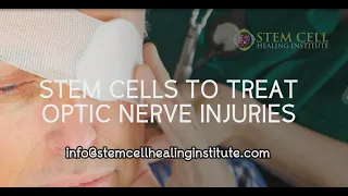 Stem Cells for Optic Nerve Injuries