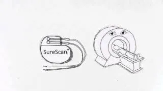 Medtronic SureScan® MRI