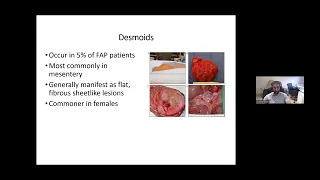 G-ECHO Fellows session : Familial Adenomatous Polyposis