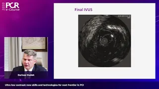 Ultra low contrast: new skills and technologies for next frontier in PCI - PCR e-Course 2020